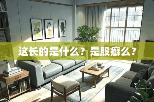 这长的是什么？是股癣么？
